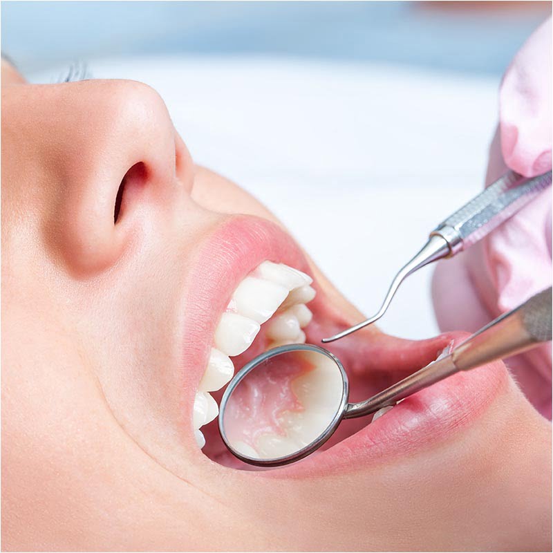 Dental Treatment_scalled Dental Treatment Windsor