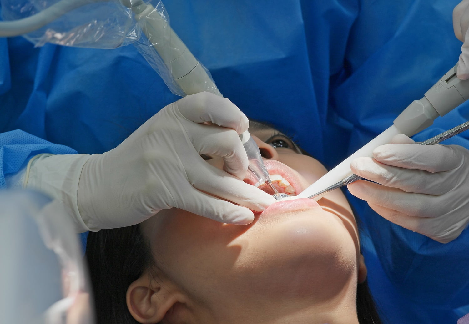 Woman undergo dental scaling treatment Composite Fillings Homecare