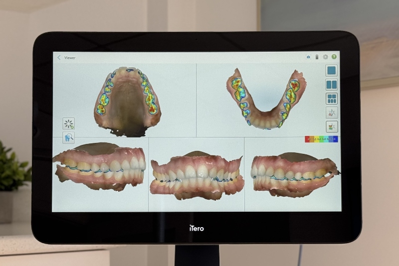 ORAL HEALTH SCAN (1) dentist near me