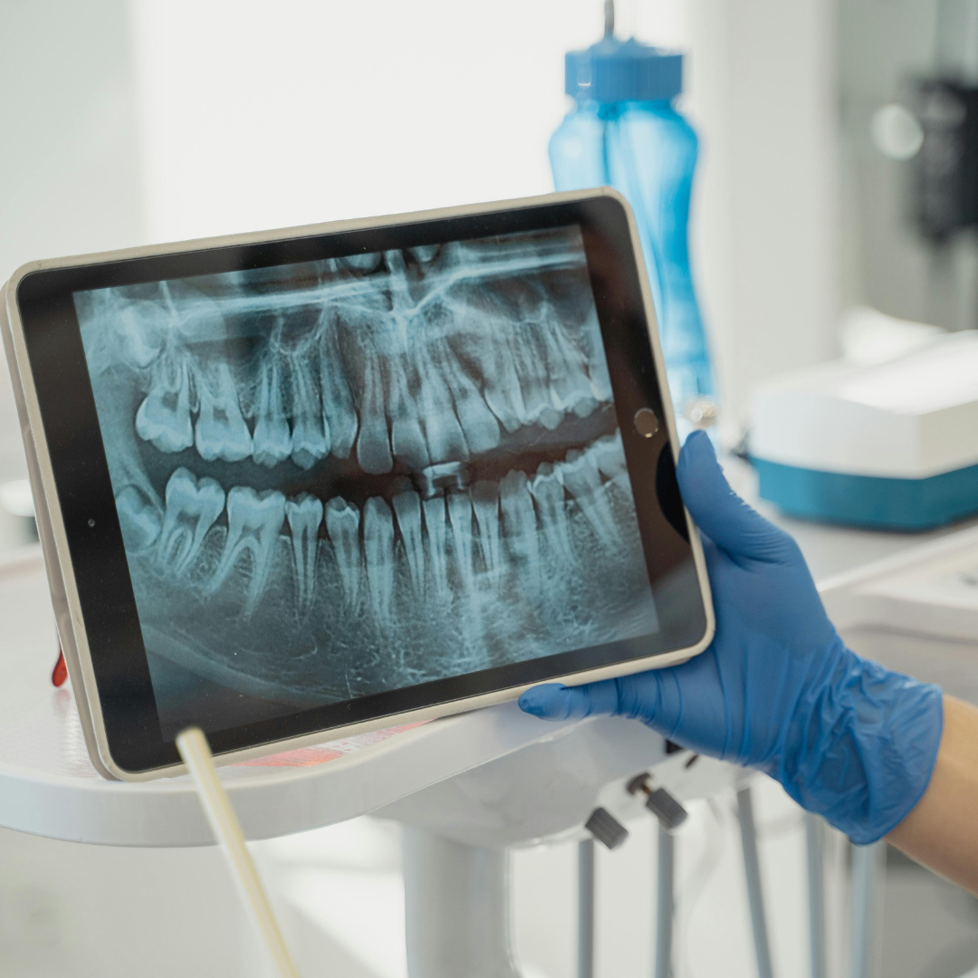 Untitled design (53) Emergency Dental Care Windsor