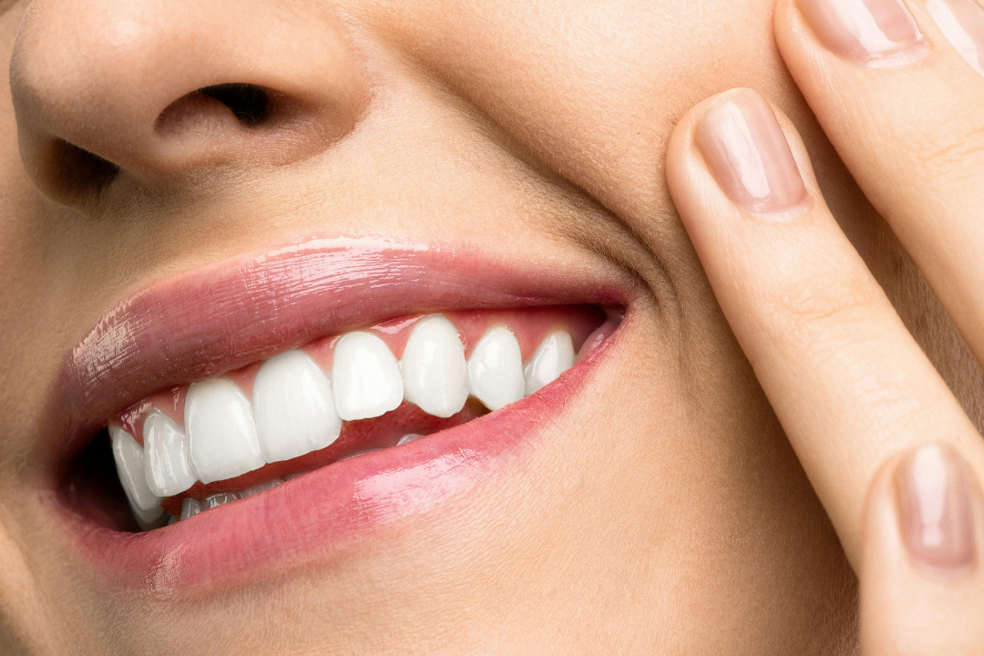 Untitled design (62) Teeth Whitening