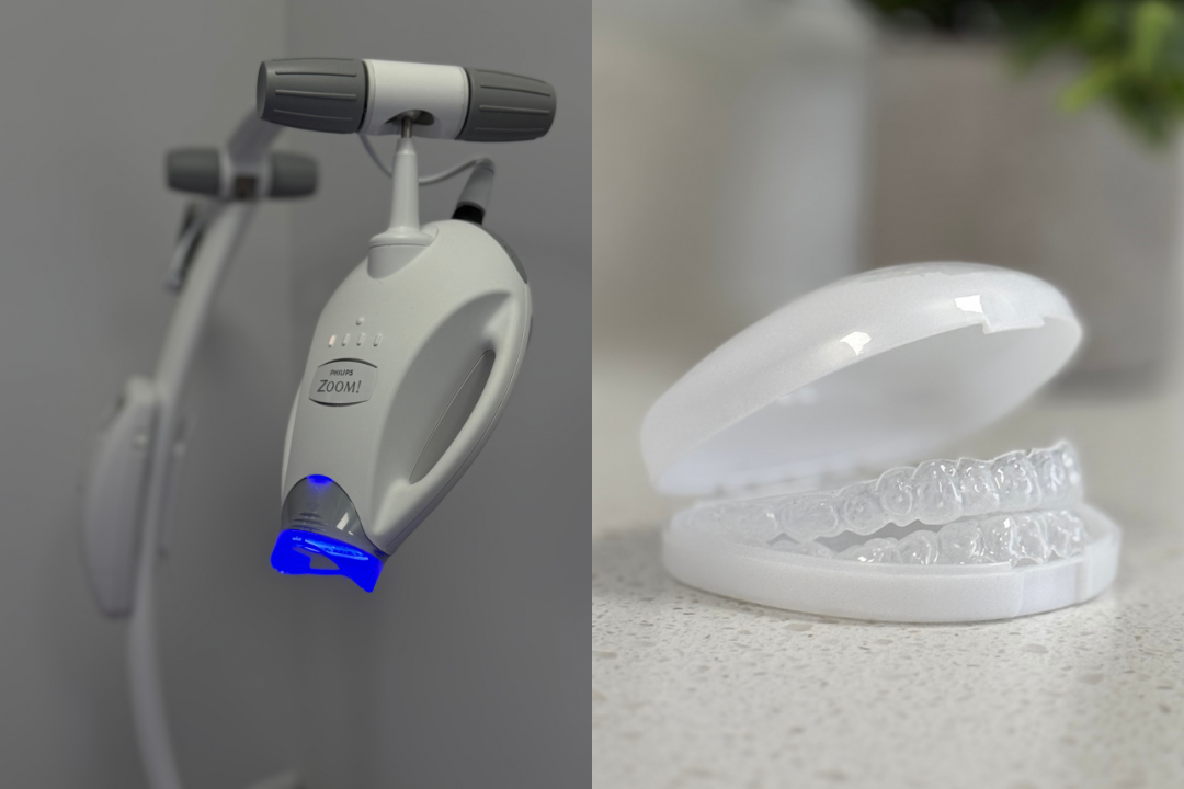 Teeth Whitening