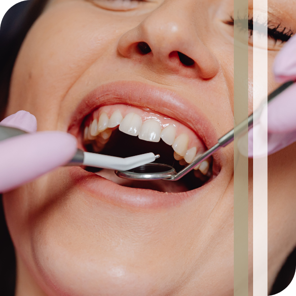Implant Desntistry Woman at the dentist